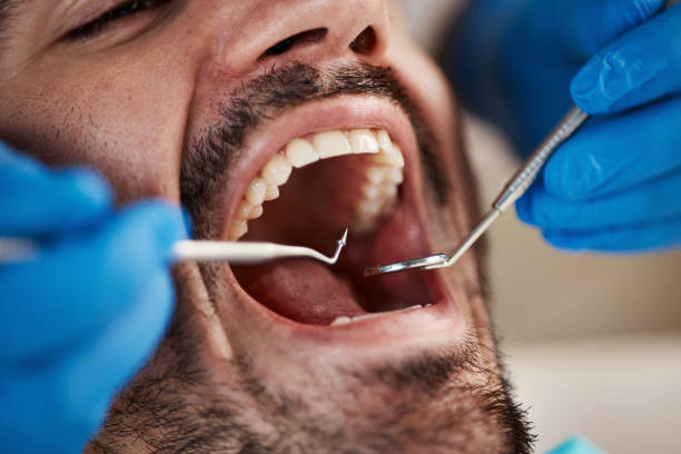 Professional Emergency Dental Service in LA